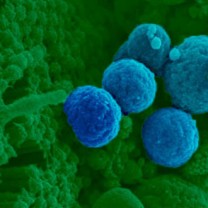 Bakterier i blått sittande på slemhinnecell (grön) i tarmen.