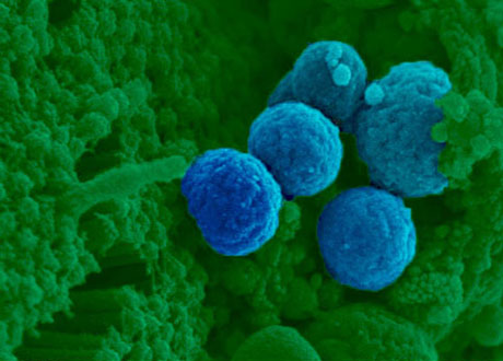 Bakterier i blått sittande på slemhinnecell (grön) i tarmen.