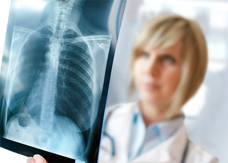 kvinna bakom röntgenplåt