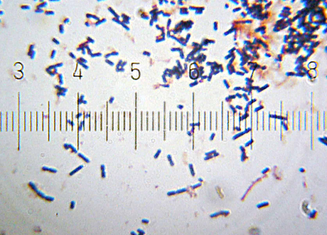 Gramfärgade Lactobacillus acidophilus. Avståndet mellan varje streck är 1,2 µm.  Foto: Bob Blaylock via Wikimedia Commons