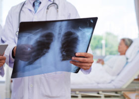 kvinna ligger i sjuksäng läkare bredvid tittar på röntgenbild av lungor