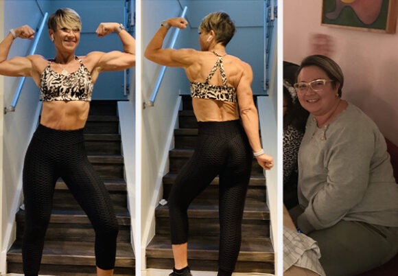Kvinna före och efter viktnedgång