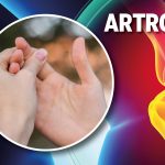 Artros: Går artros att bota?
