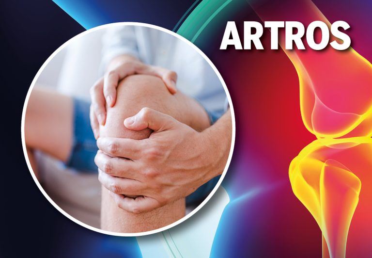 Artros: Hur vet du om värken är artros?