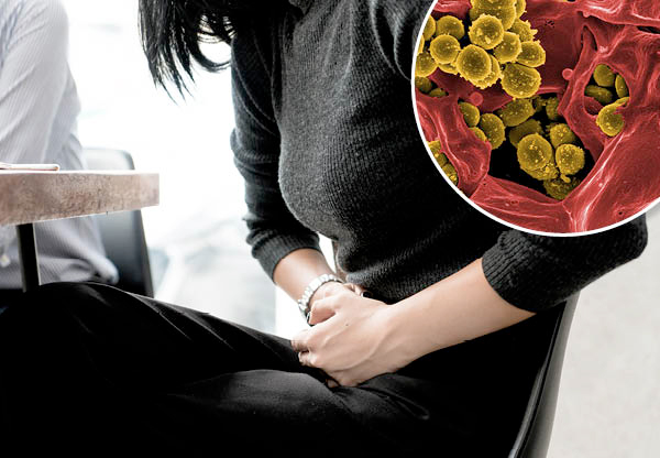 Bakterier kan ligga bakom endometrios