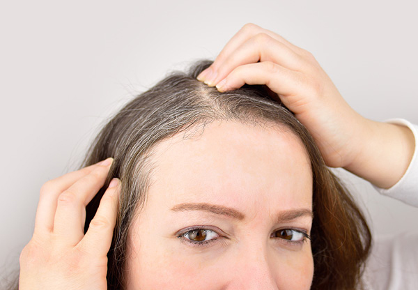 Studie: Därför får vissa grått hår för tidigt