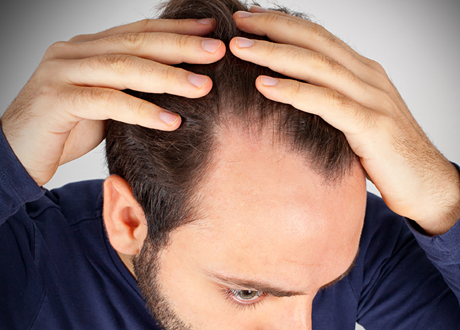 Näringen som motverkar håravfall