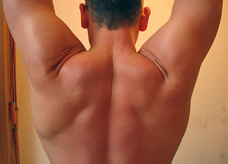 Vältränade muskler ett skydd mot stress och depression