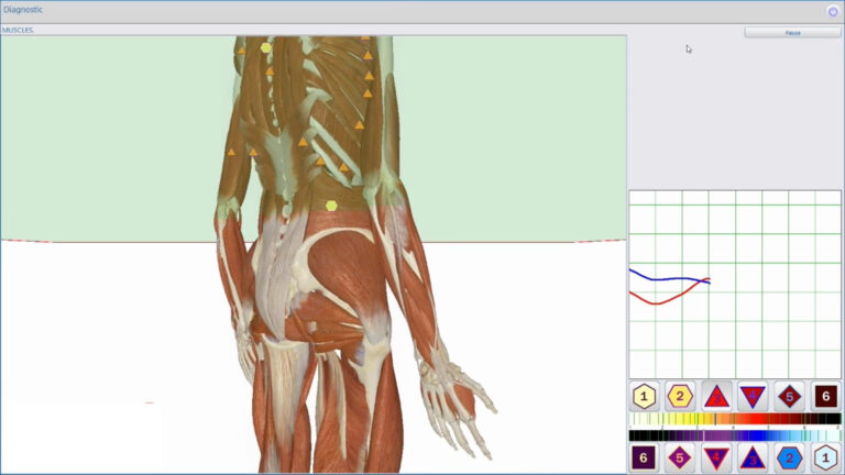 Illustration av en människokropp i 3D med Metatron Hospital